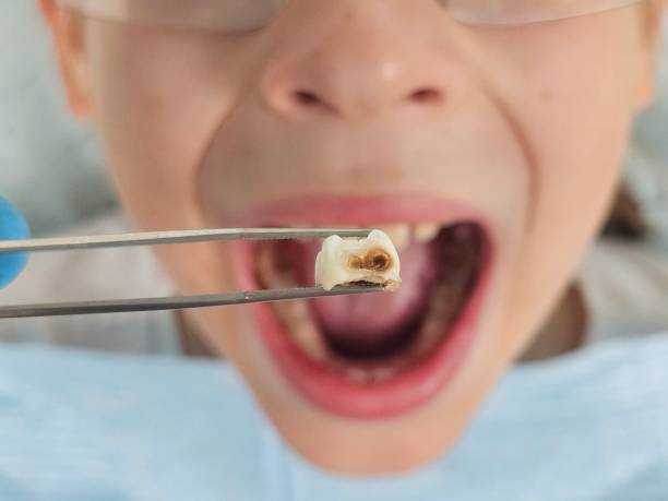 Best Emergency Denture Repair in Hornell, NY